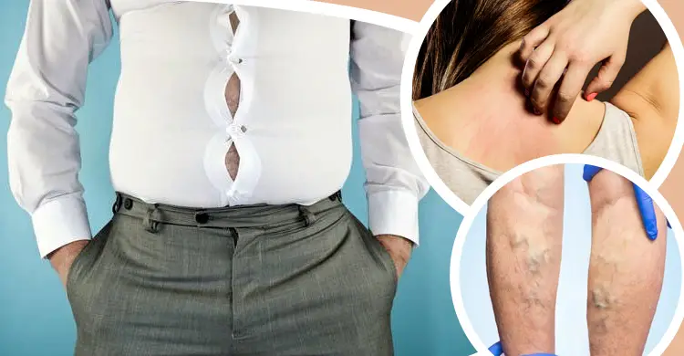 টাইট কাপড় নারীদের স্বাস্থ্যে কী প্রভাব ফেলে